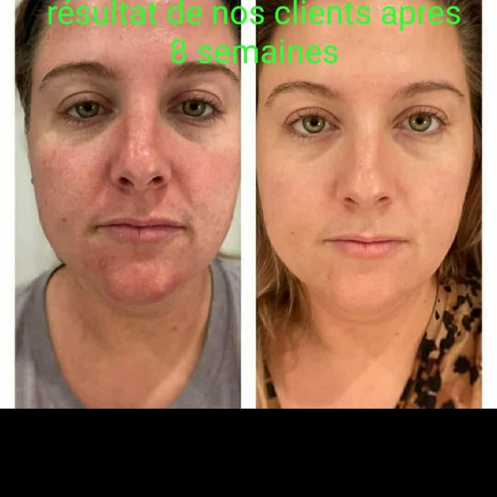 Clinical retinol